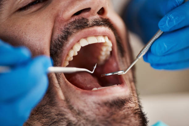 Best Walk-In Emergency Dentist in Cambridge, NE