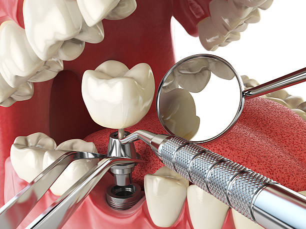 Best Emergency Dental Care for Trauma or Injury in Cambridge, NE